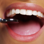 Wszechstronne leczenie dentystyczne – odkryj trasę do zdrowych i pięknego uśmiechów.
